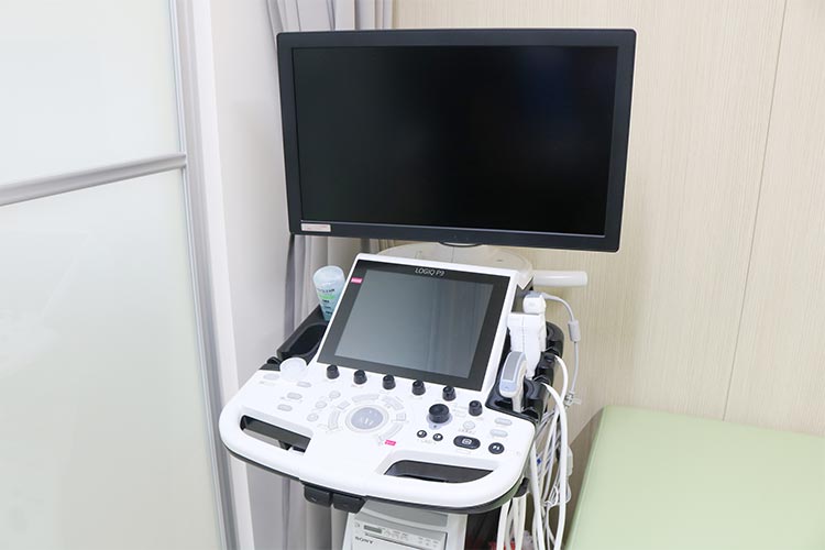 超音波診断装置